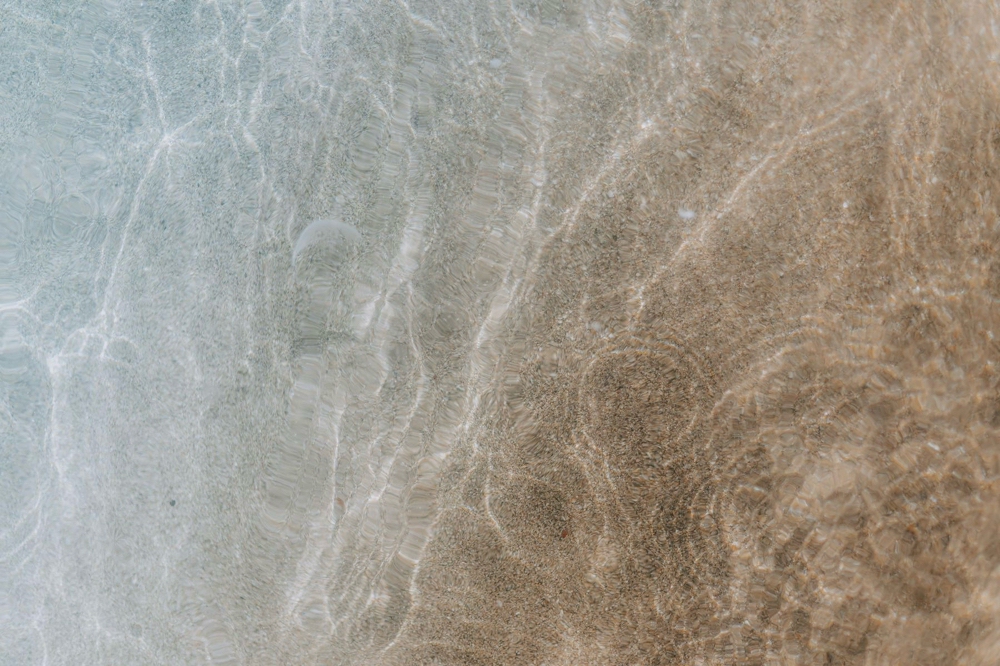 Add On: Microdermabrasion