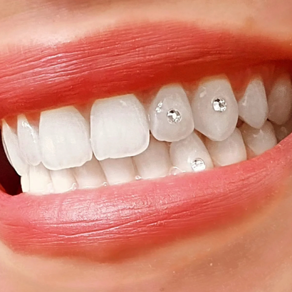 Gems at Radiant Joy Teeth Whitening in Banks, OR