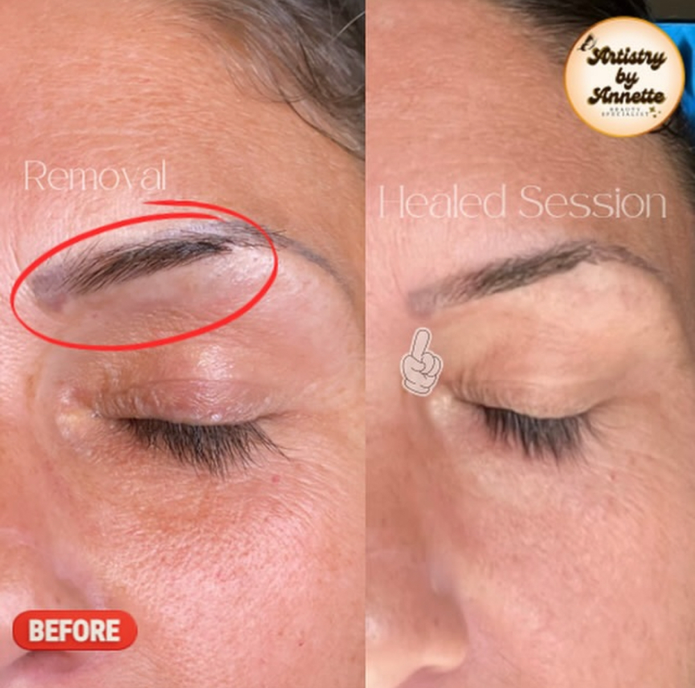 3 Saline Tattoo Removal: Brows Only at Artistry by Annette in Fresno, CA