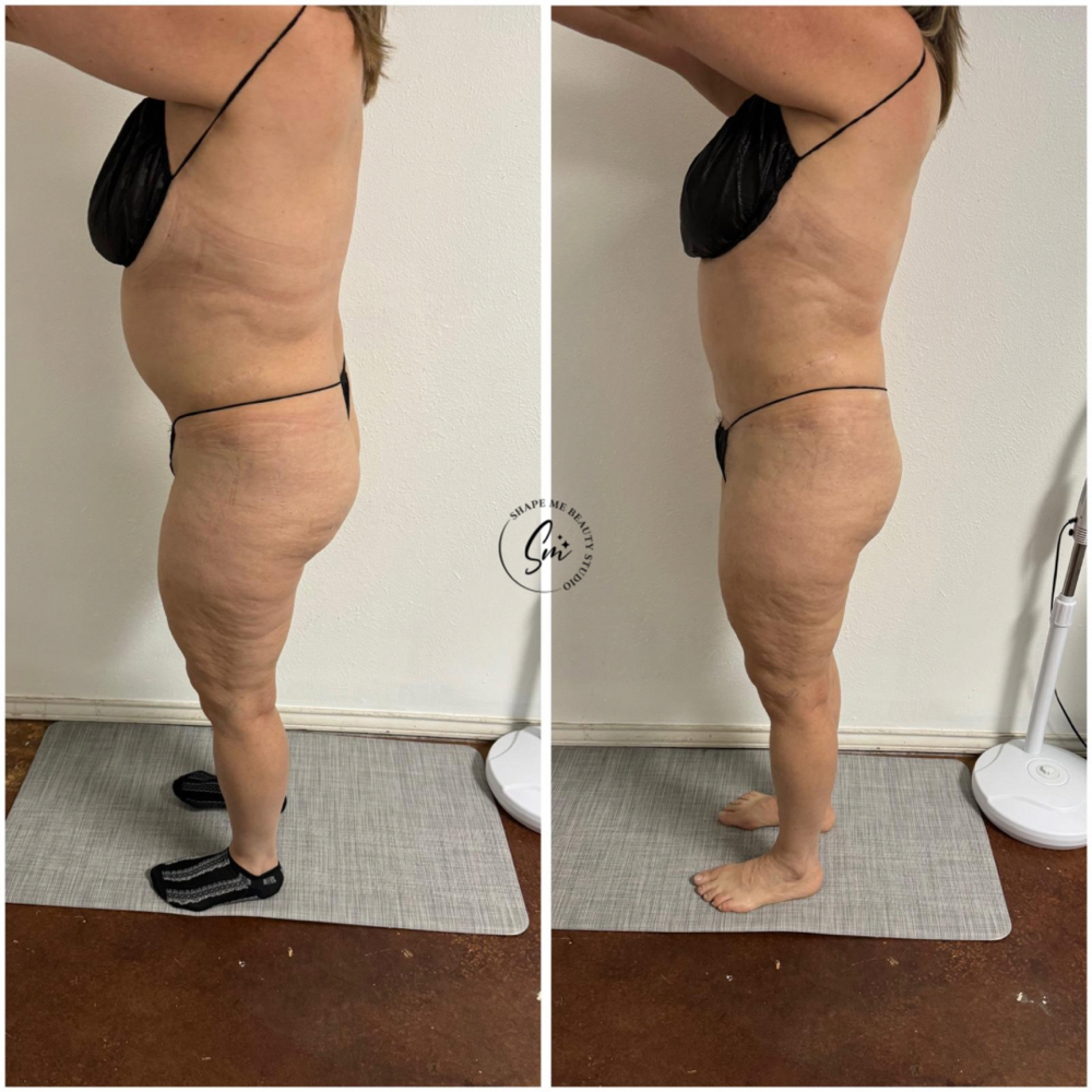 Detox Full Body at Shape Me Beauty Studio in Midland, TX