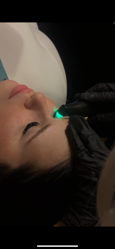 NuLids ™ Treatment Add-On