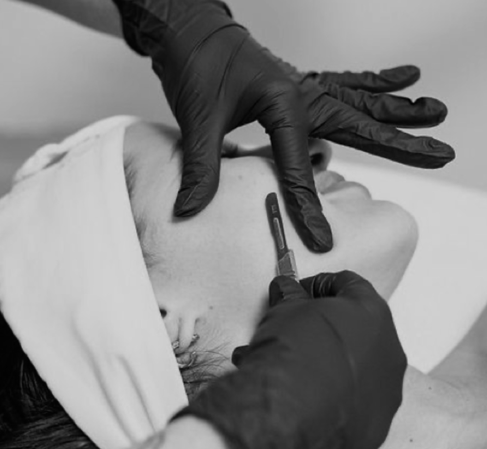 DERMAPLANE ONLY