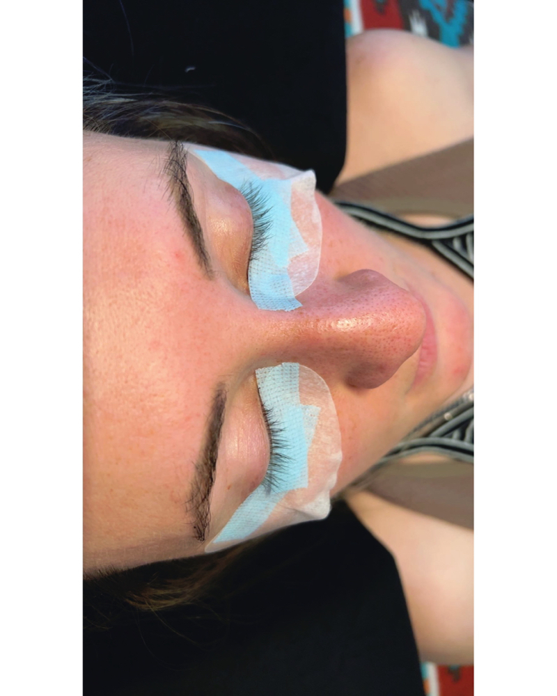Lash Removal