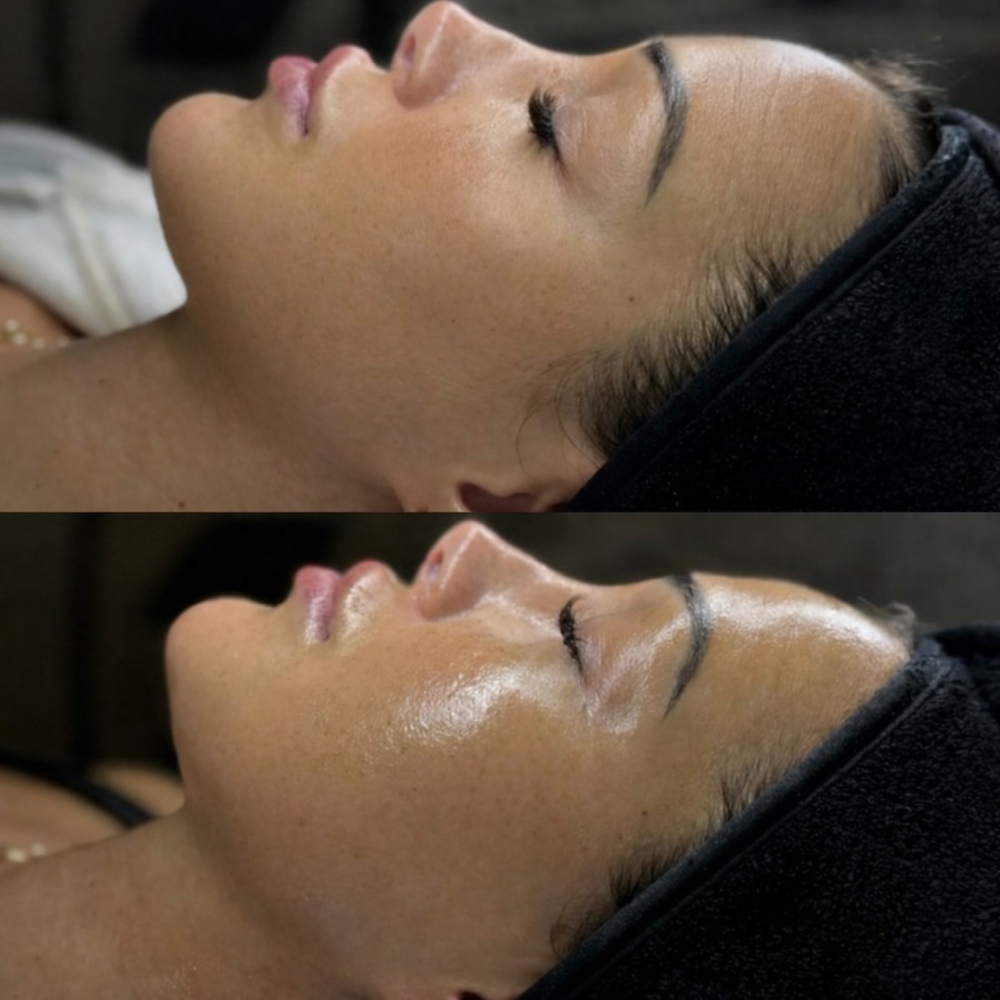 Bare GLOW Boost HydraFacial®