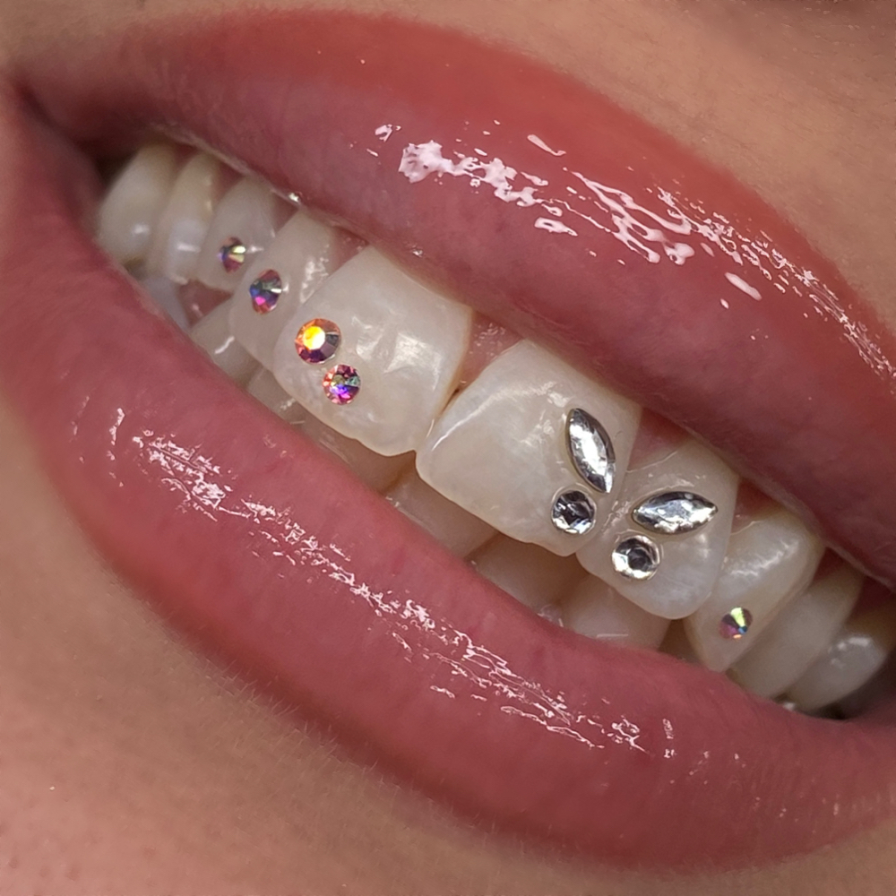 Customized Set