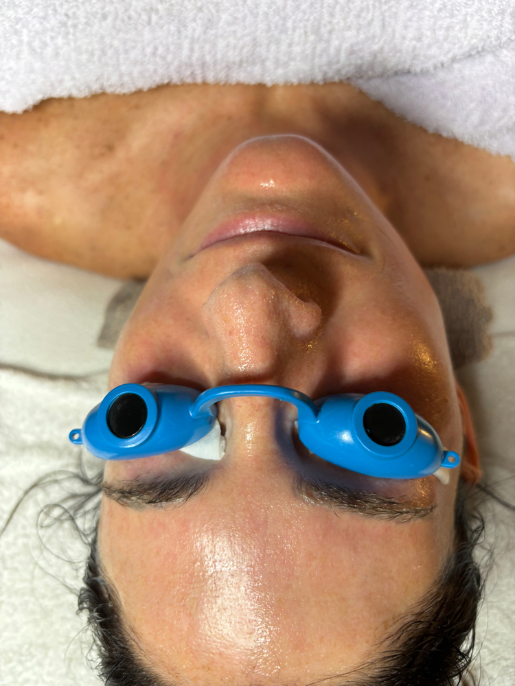 Dermaplane + O2 Lift Facial at Genie of Skin in Mooresville, NC