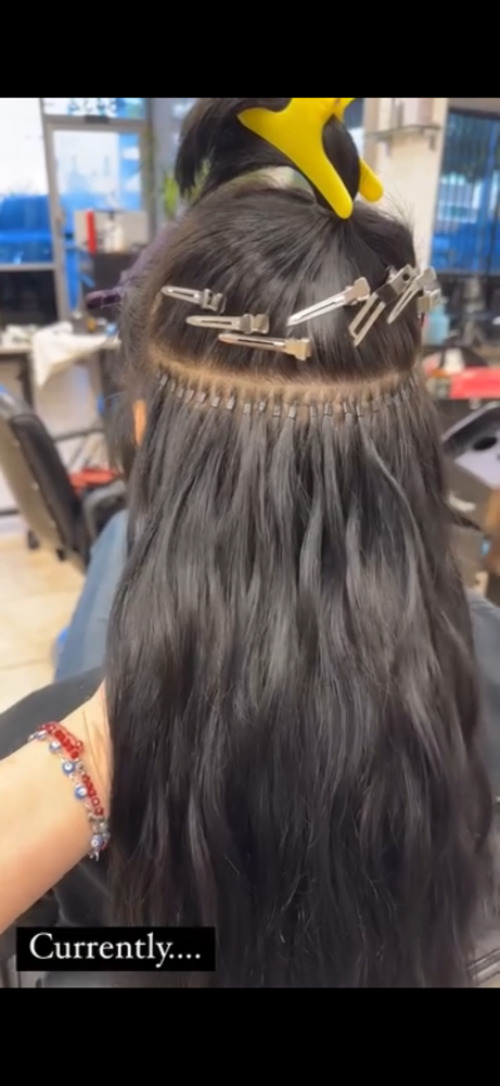 Extension Removal
