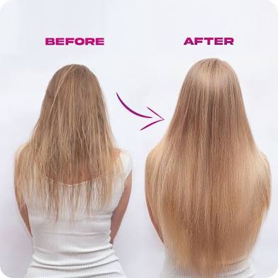 Consultation For V-light Extensions