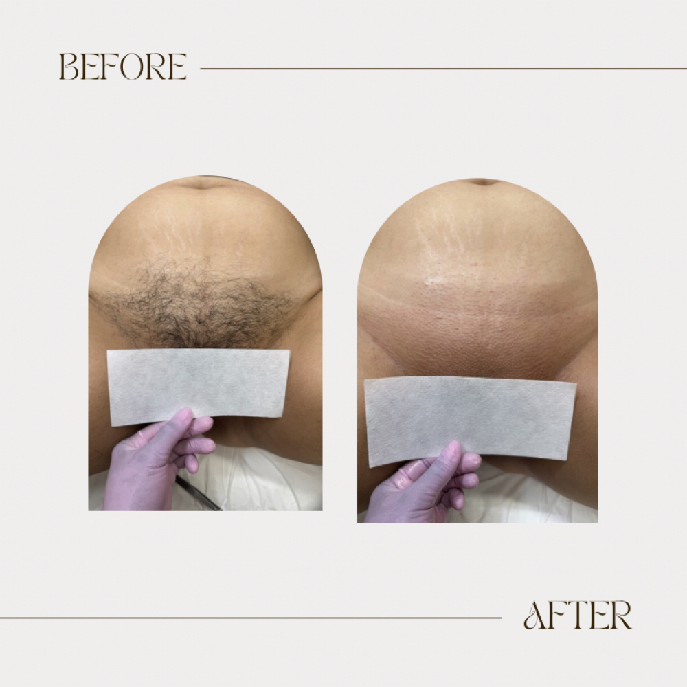Brazillian Wax at WaxedByMac in San Antonio, TX