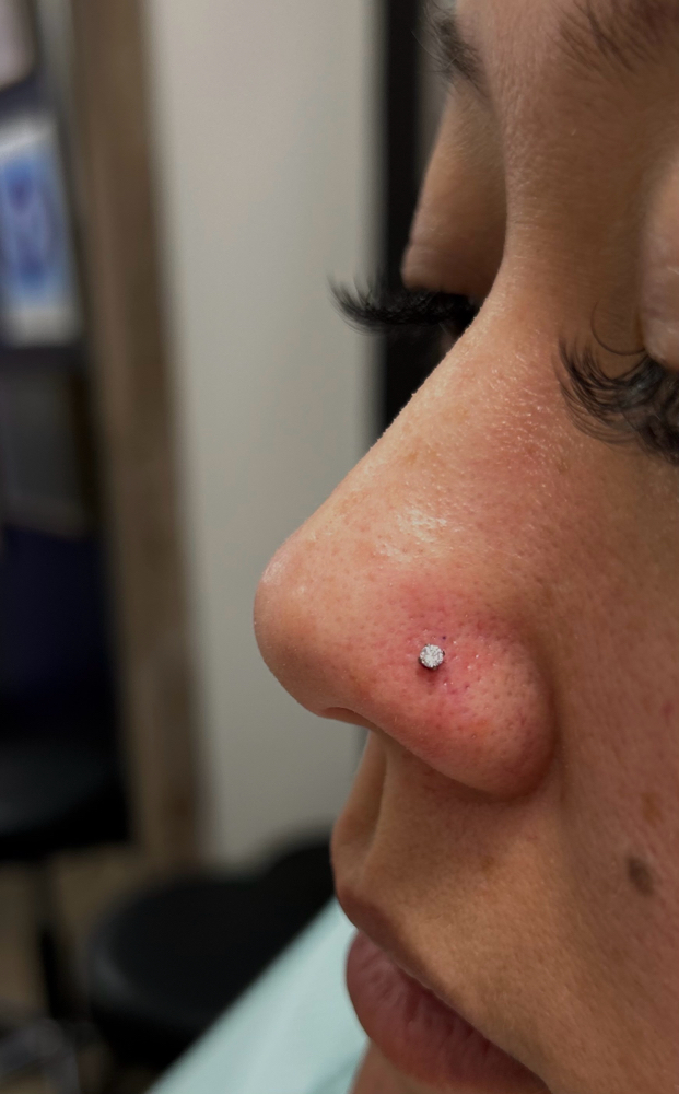 Nose