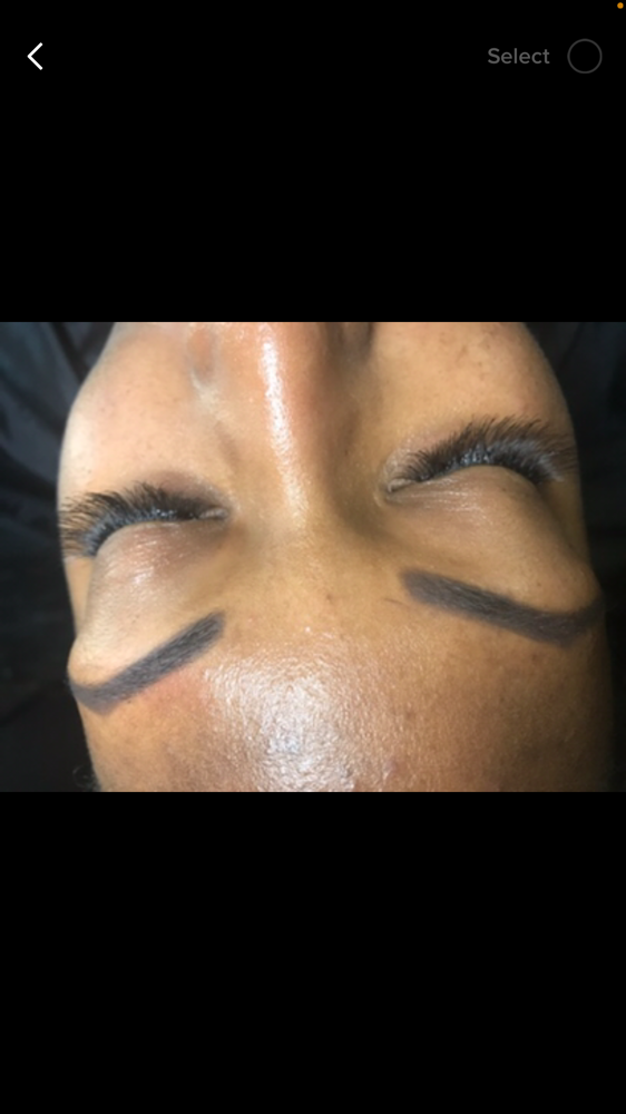 Brow Contouring