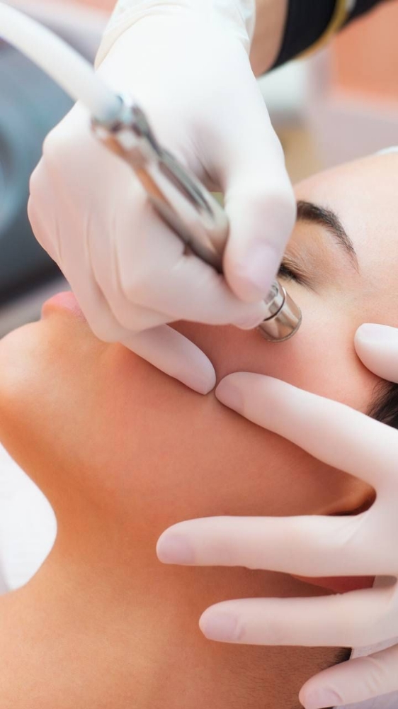 Microdermabrasion Polish