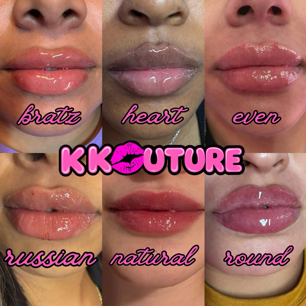 1 ML Lip Filler at k kouture in Fort Worth, TX