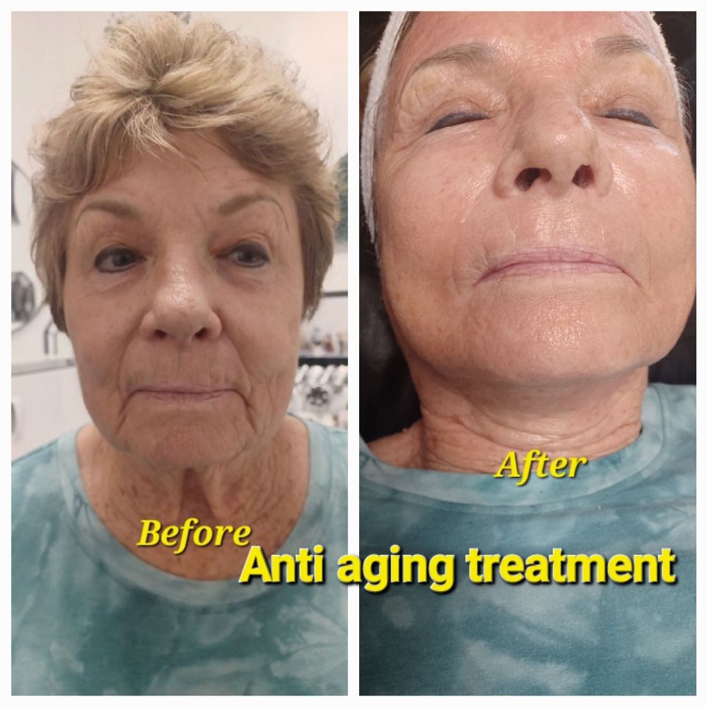 ANTI AGING FACIAL Facial