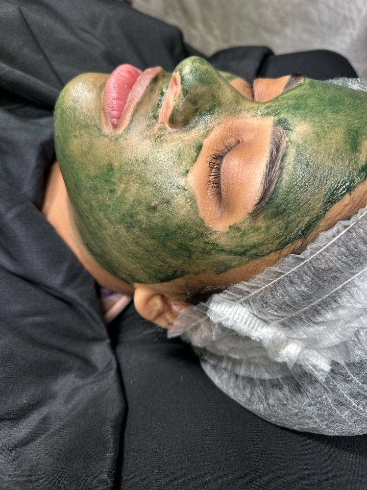 Liquid Microneedling at Loba Beauty Spa in Paterson, NJ