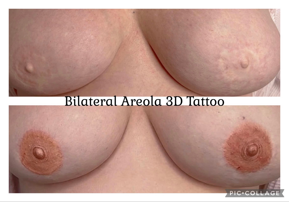 3D AREOLA