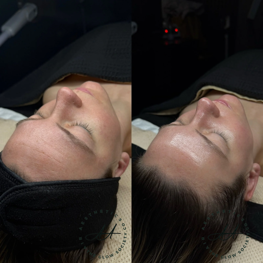 Custom Facial