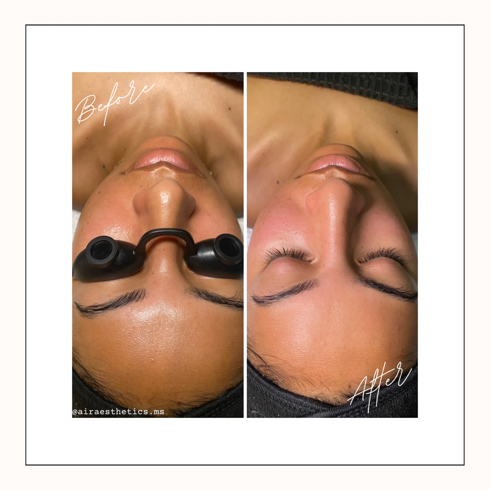 Custom Facial