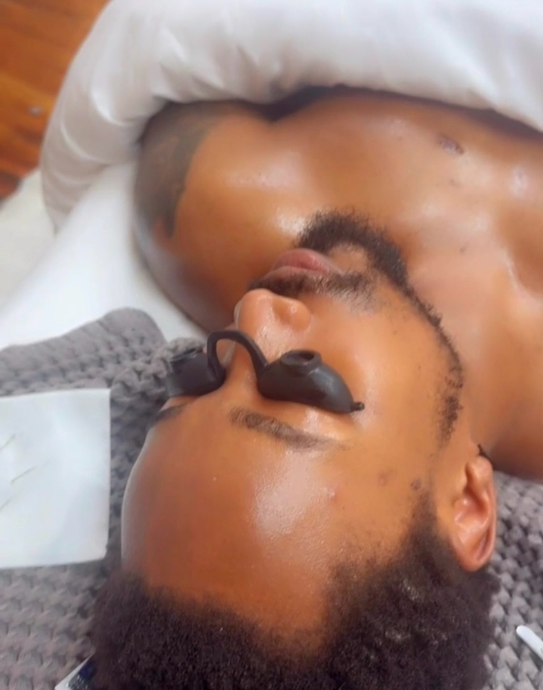 Dermaplaning
