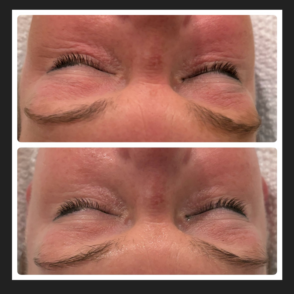 Eye Tightening Package at Me Time Beauty Spa in Southbury, CT