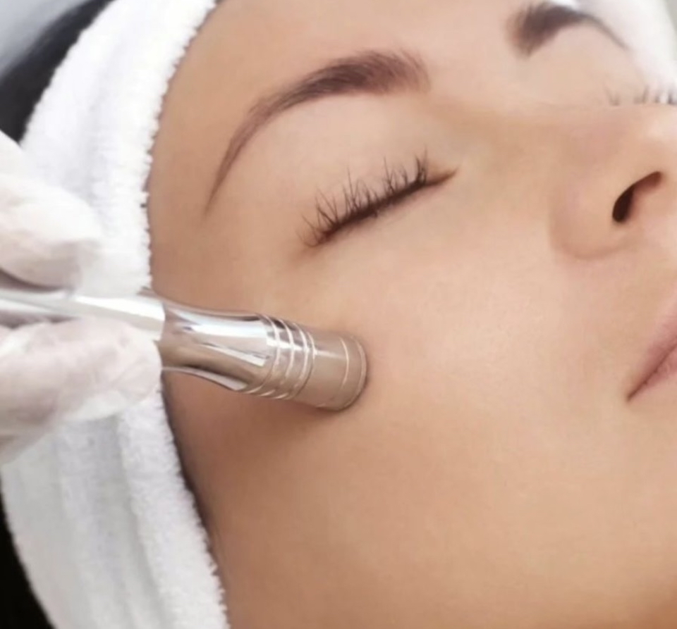 Microdermabrasion Add On