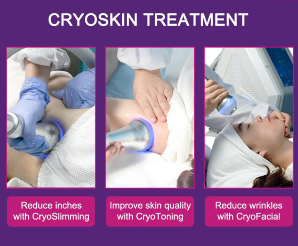 Cryo Slimming