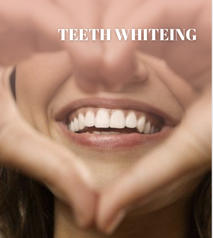 Teeth Whitening