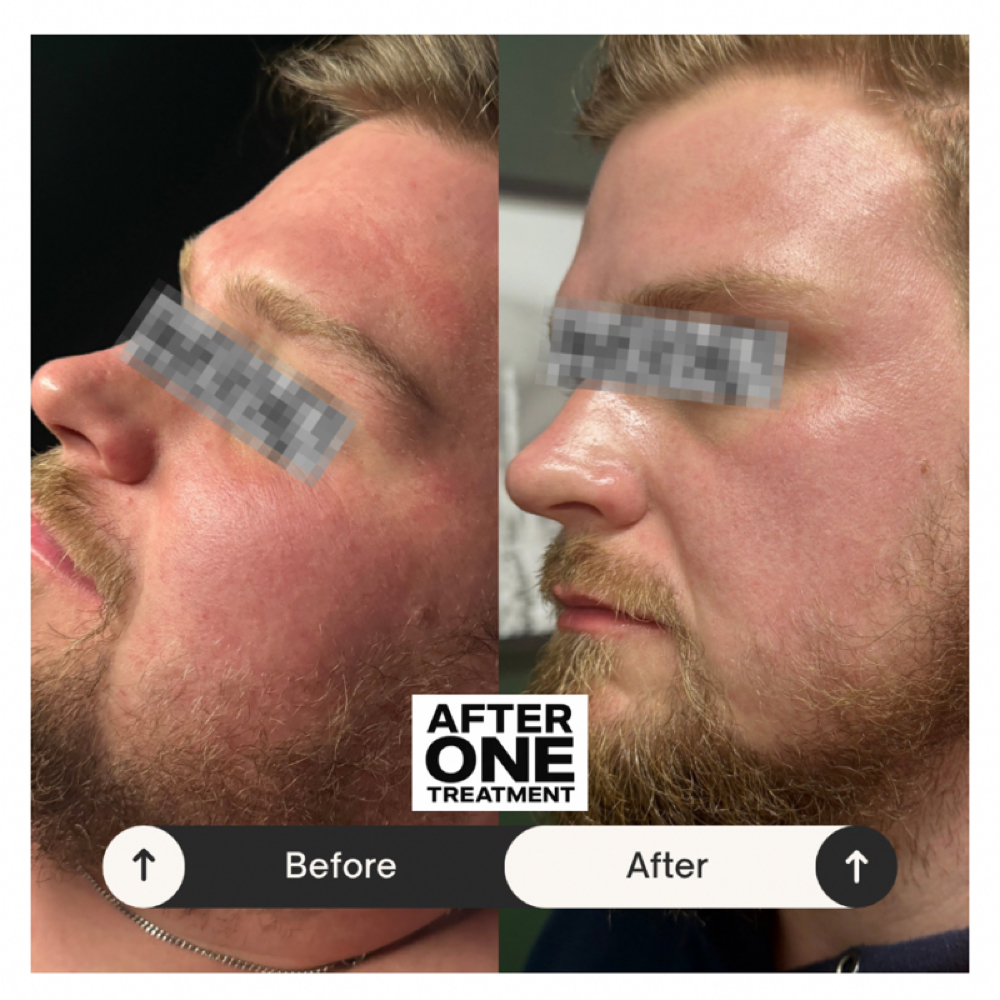 Modern Gentleman’s Facial at Gemini Esthetics in Naperville, IL