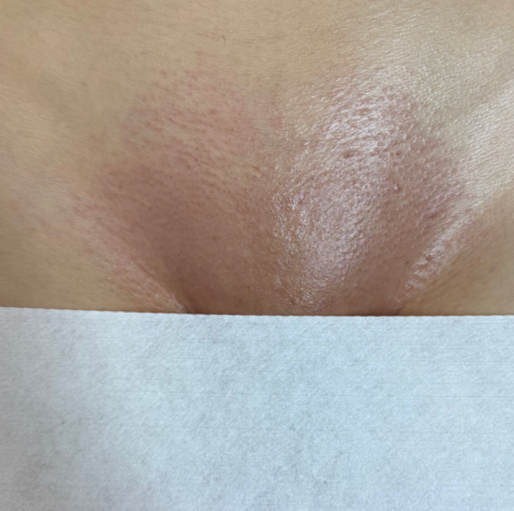 Full Bikini at Classic Waxing Co in La Habra, CA