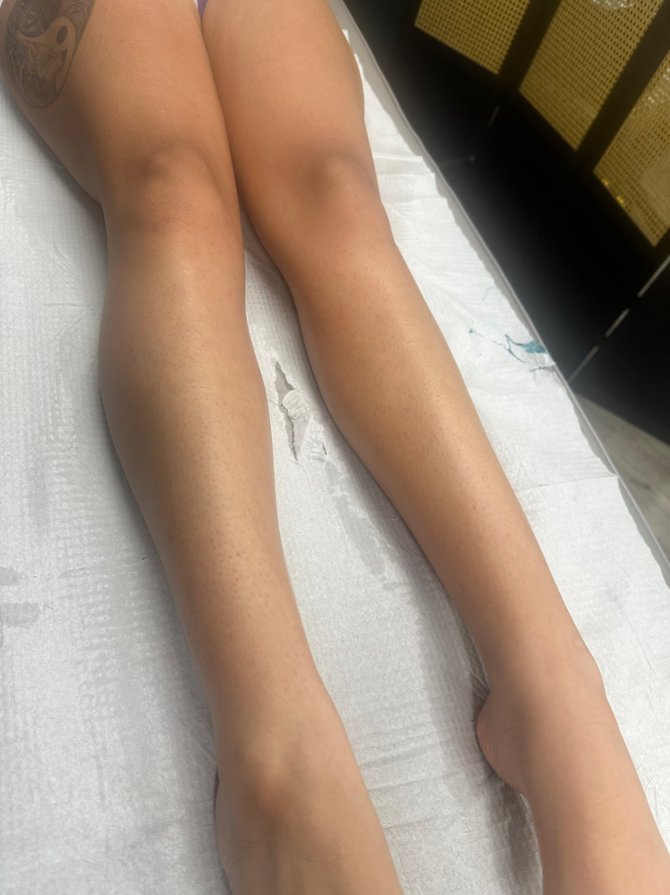 Lower Legs