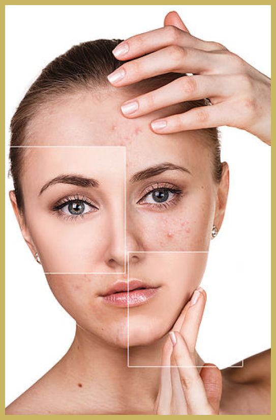 Clarifying Facial