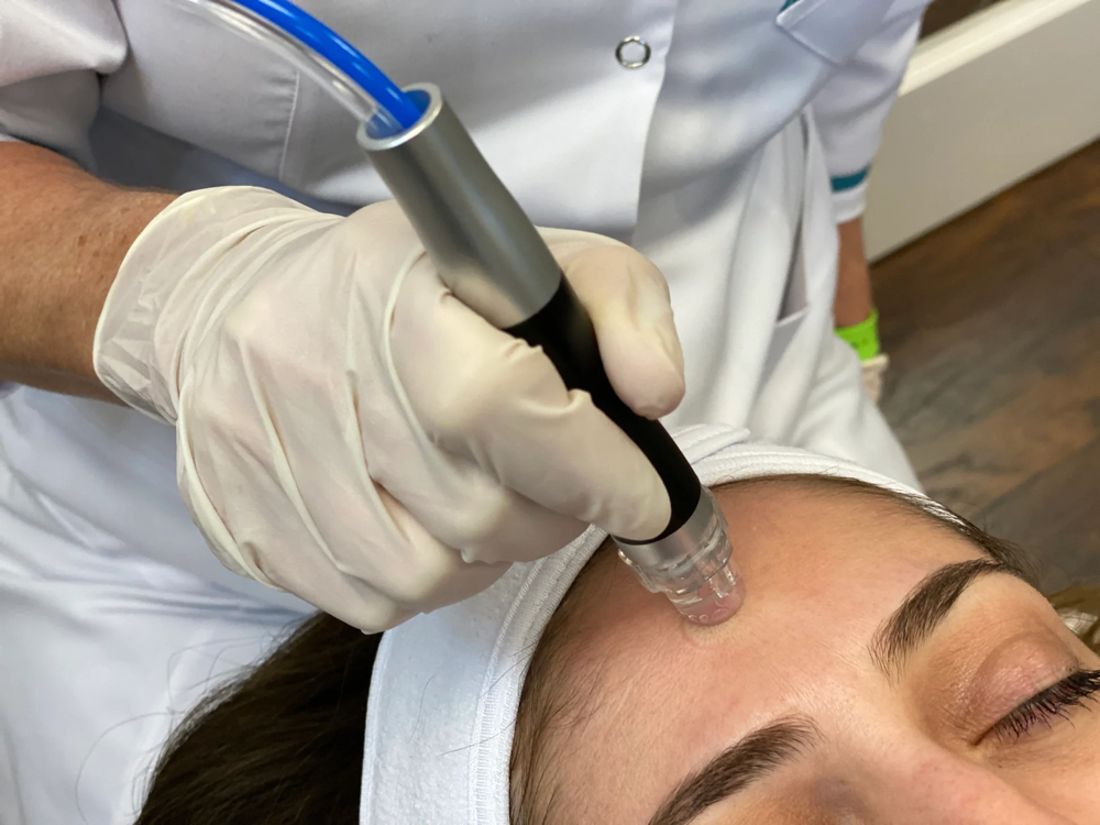 Hydrodermabrasion Glow Facial ✨