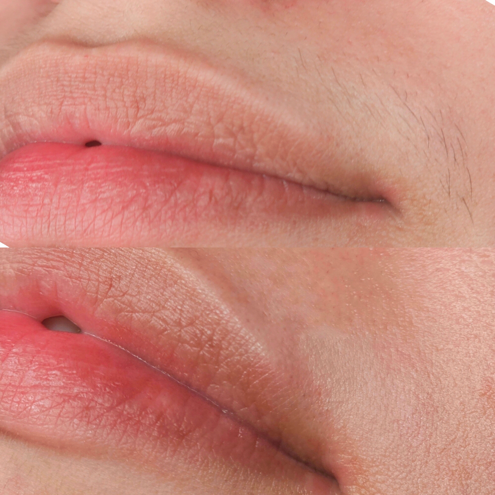 Upper Lip Wax at Bubalu Skin in Elgin, IL