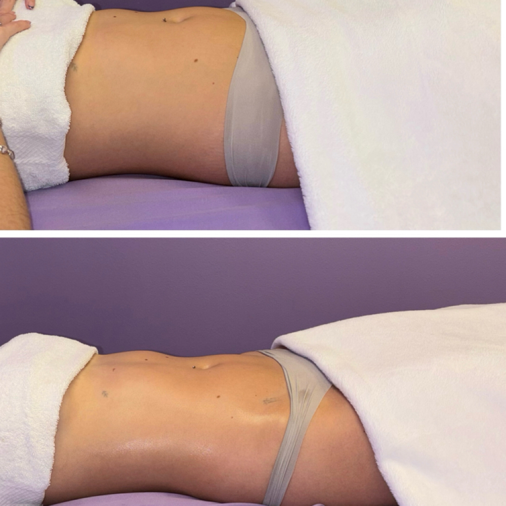 BOGO 1/2 Half Brazilian Lymphatic at Divinity Essence Spa in Winter Springs, FL