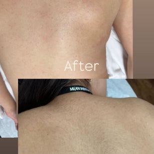 Full Back Wax at Inclusive Esthetixs in CA, CA