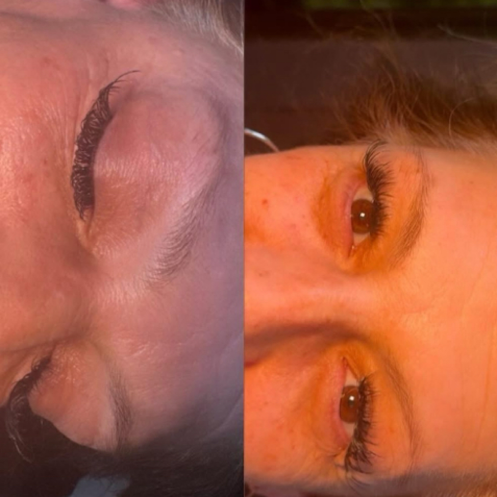 Hybrid Clusters at Queensmade Esthetics in Wilmington, NC