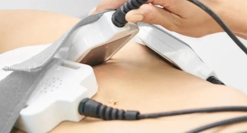 Laser Lipo