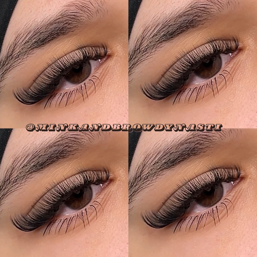 Hybrid Fill at SOCL Esthetics in Indianapolis, IN