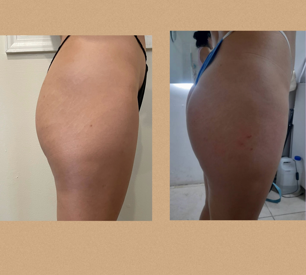 Pompas Garota at D&K Beauty&Spa in Newpor News, VA