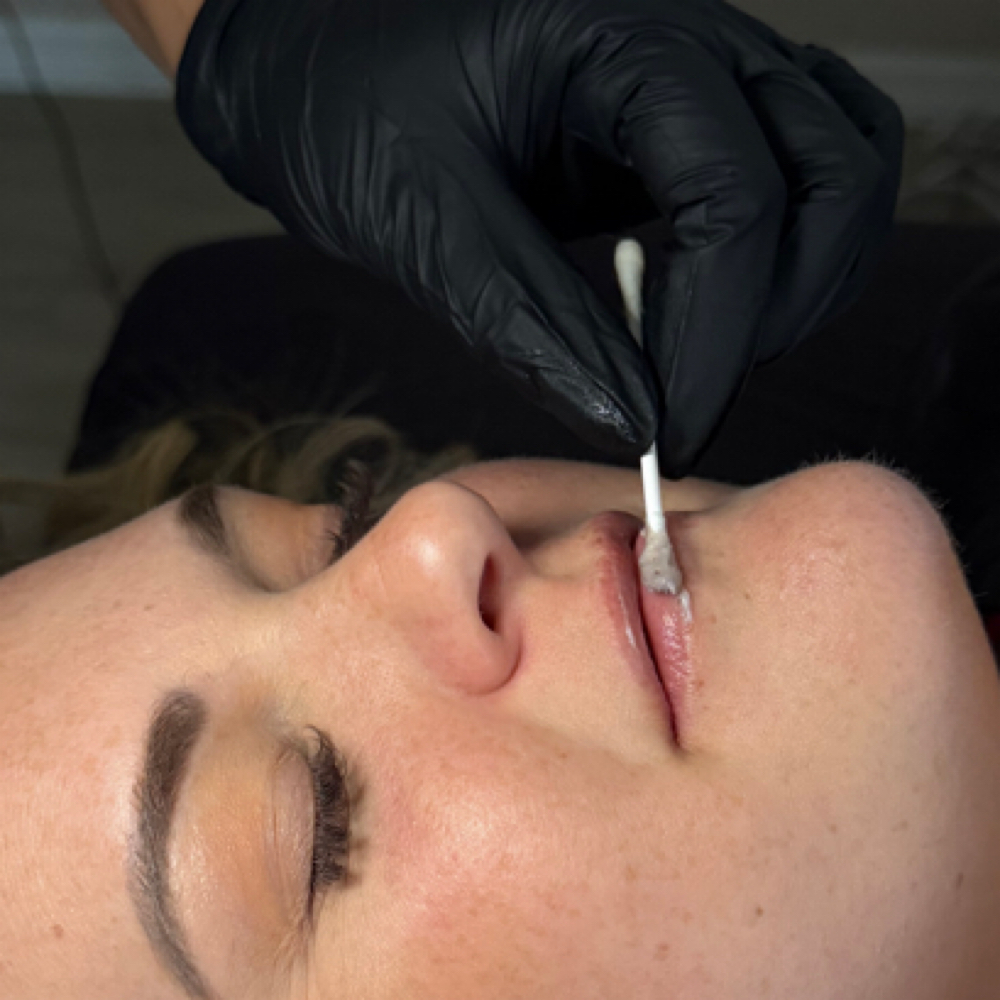 Pucker Up - Lip treatment Add On