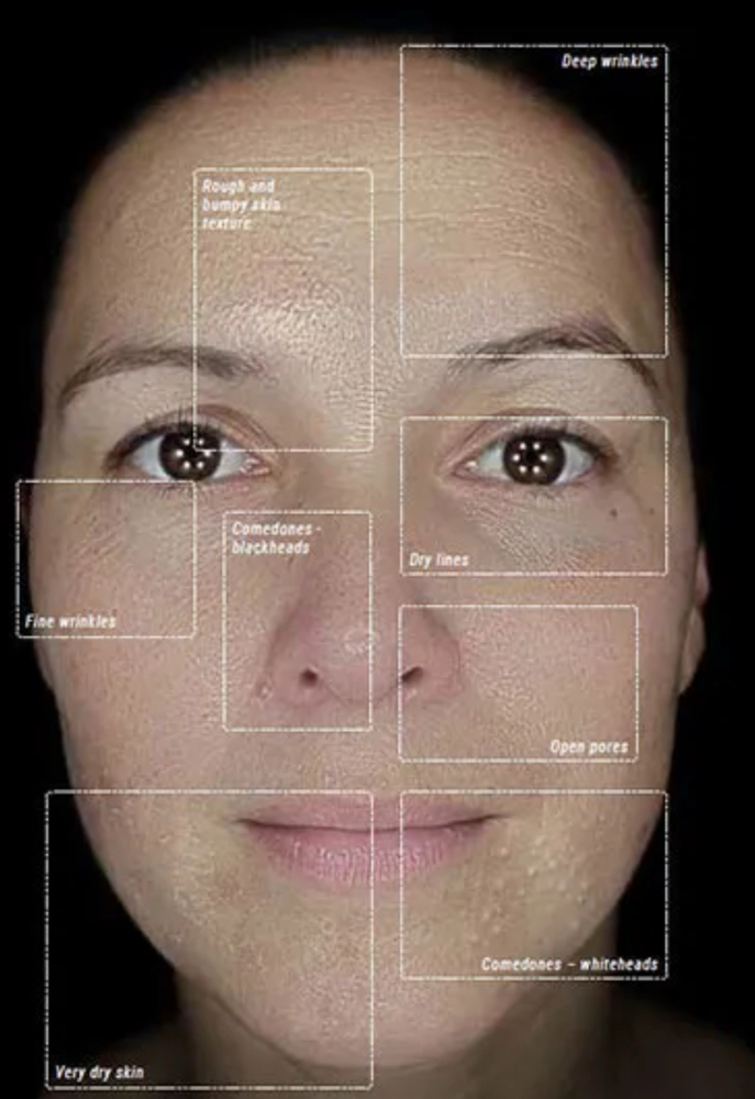 DermaSensor + Skin IQ Scan at Effortless Esthetics LLC in Scottsdale, AZ