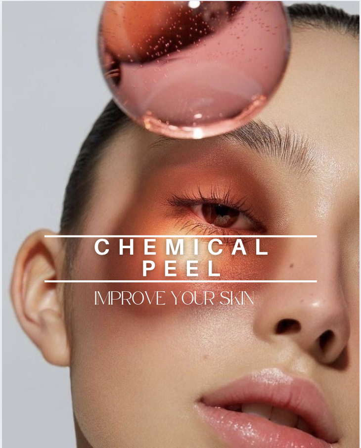 Chemical Peel
