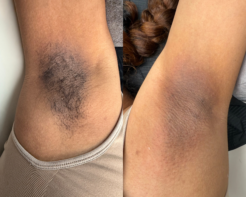 Underarm Wax at jennyestheticss in Winston Salem, NC