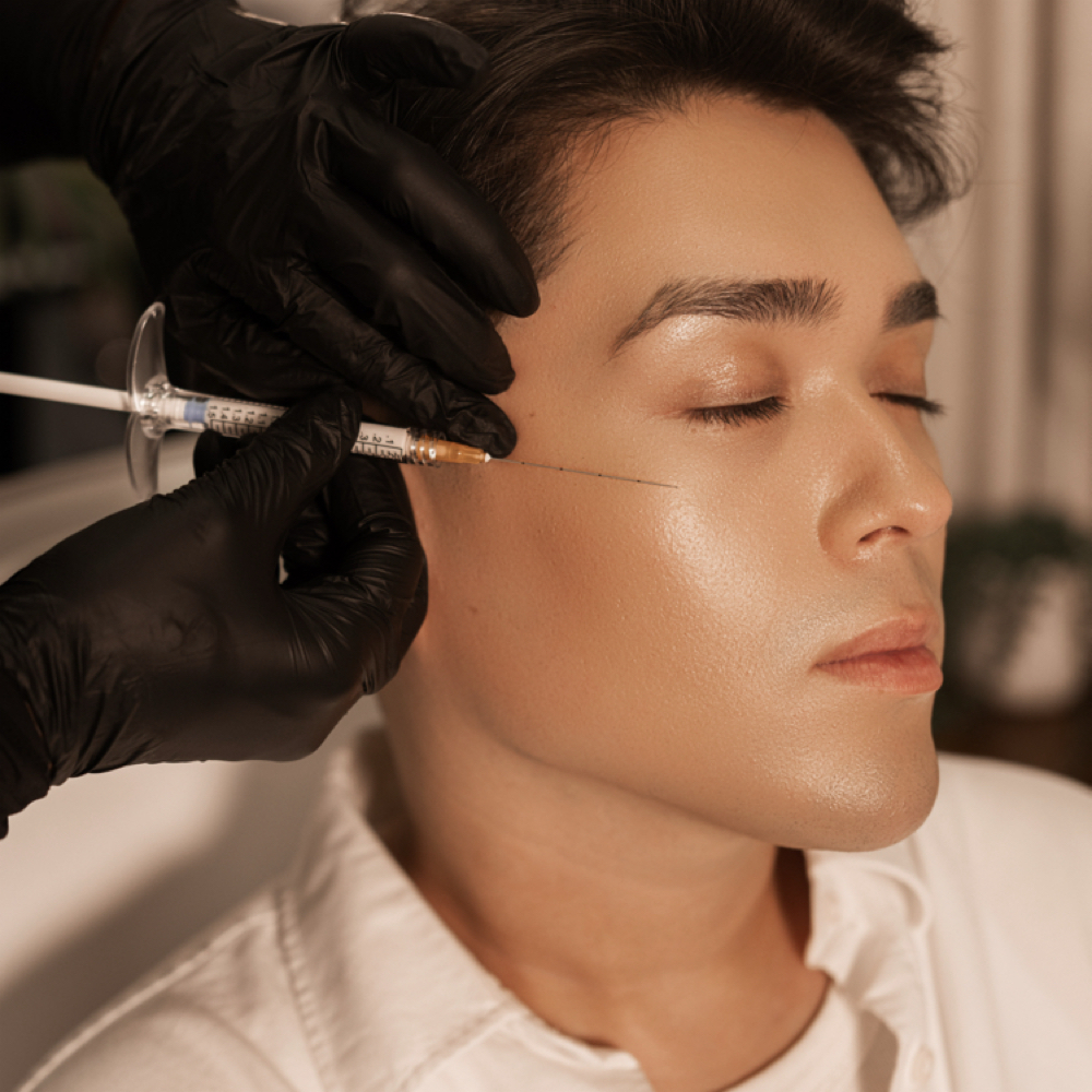 Radiesse (Bio-Stimulator) at Fina Aesthetics in Houston, TX