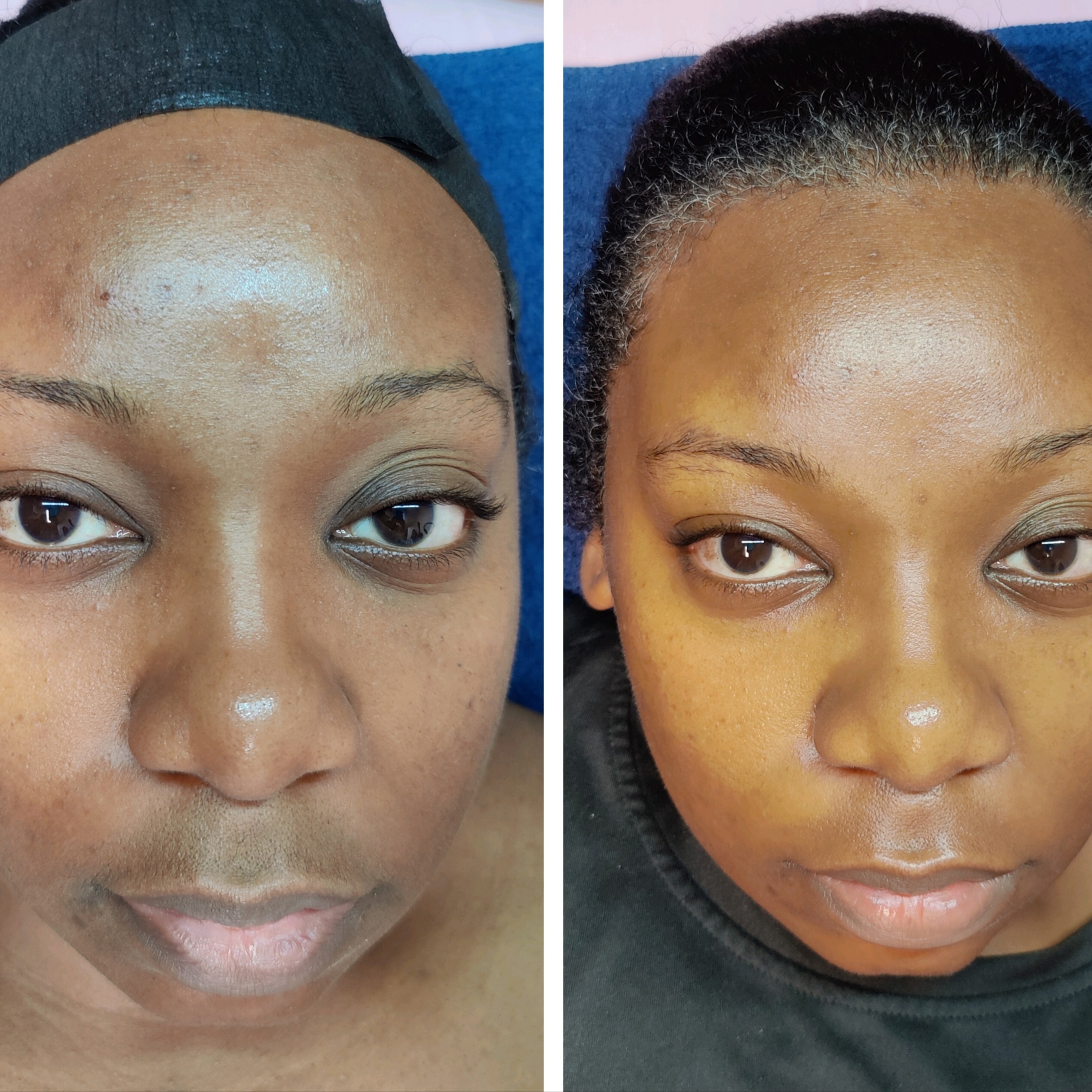 The Reveal Facial (Dermaplane) at Twistykinks & Twist of Elegance Esthetics in Jacksonville, AR