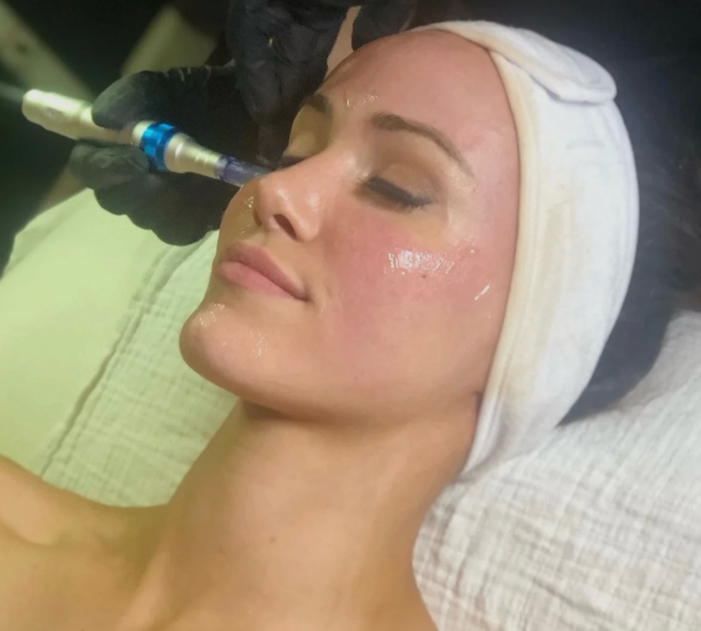 Nano Infusion W/ Dermaplaning