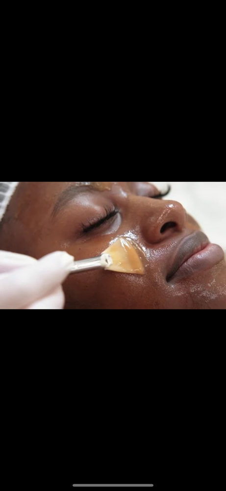 Peel & Dermaplane Plane Facial