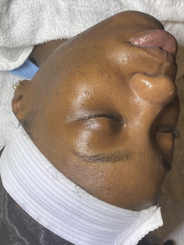 Teen Facial