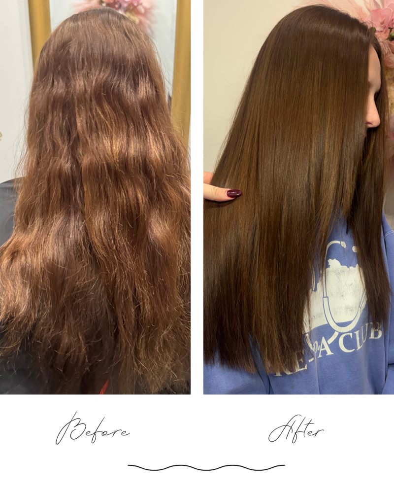 SmoothFiller Treatment