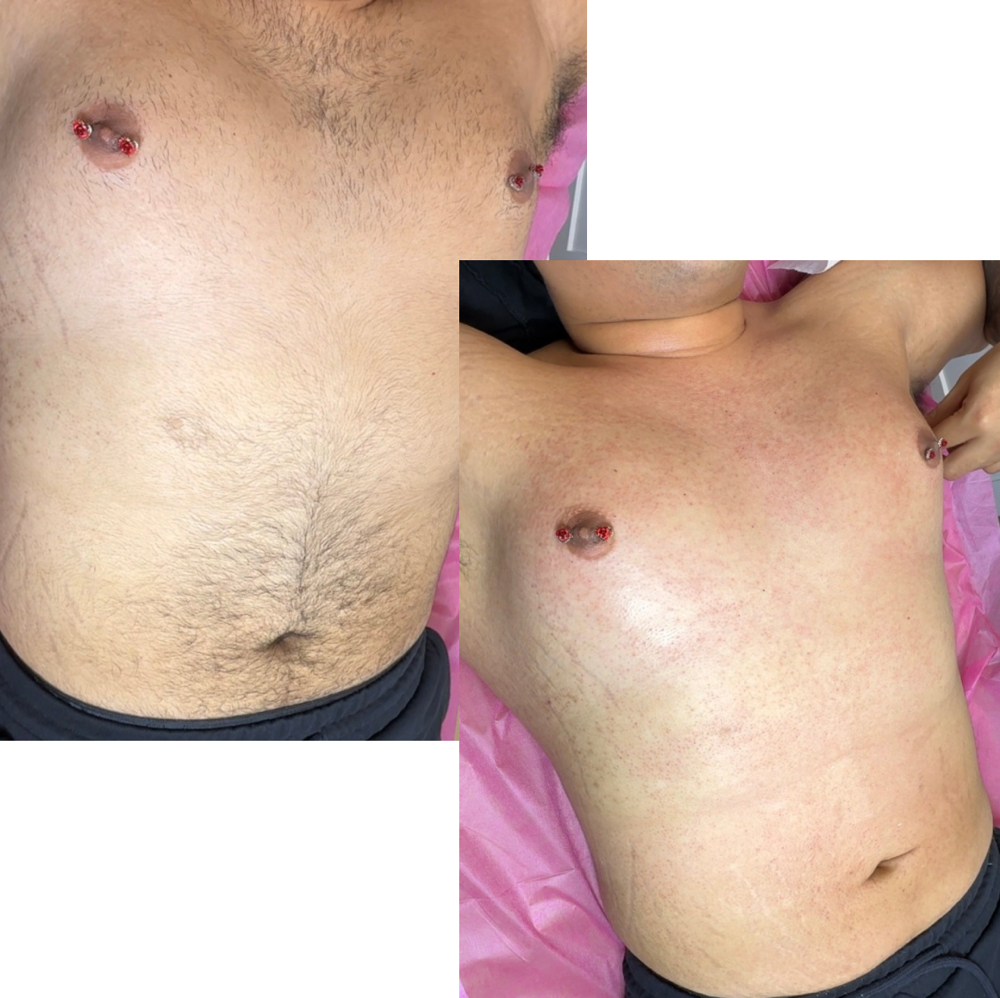 Full Stomach + Chest at Classic Waxing Co in La Habra, CA